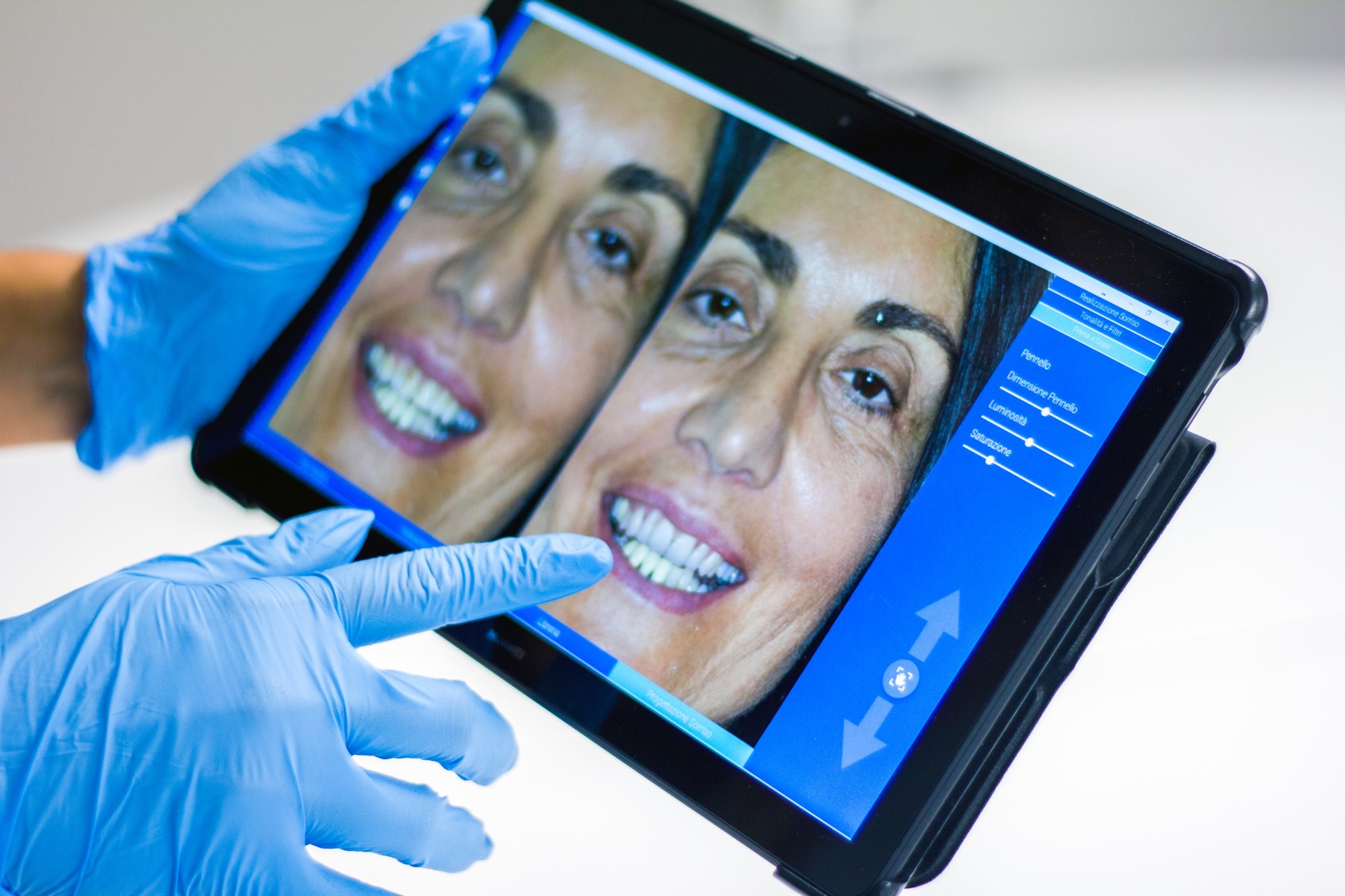 dental implants